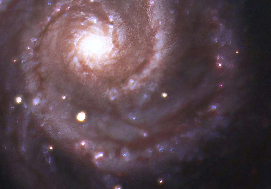 M51 severe