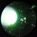 Contaminants microscope high Mag